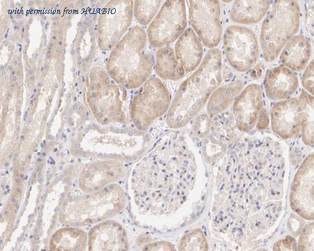 HUABIO HA750896 image 2