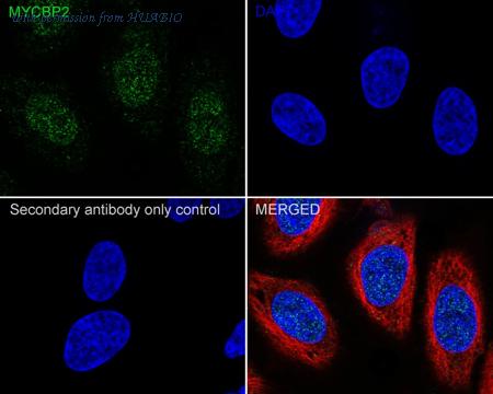 HUABIO HA750902 image 2