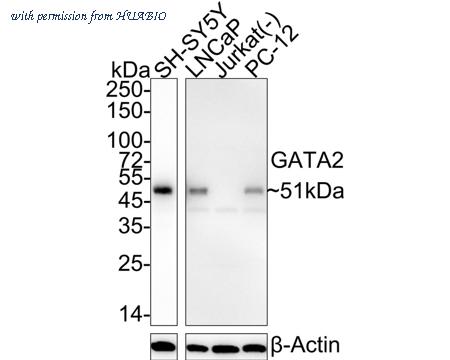 HUABIO HA750960 image 1