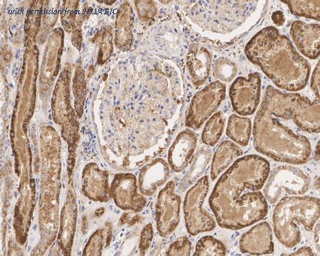 HUABIO HA750964 image 2