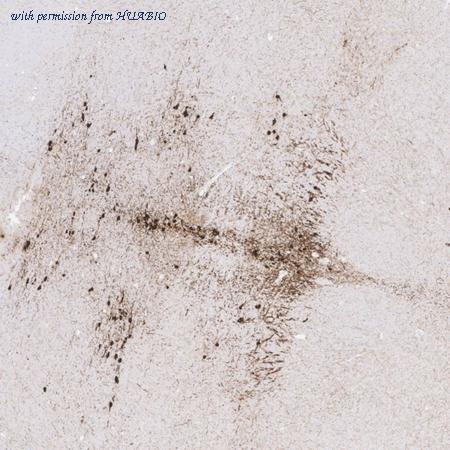 HUABIO HA750976 image 2