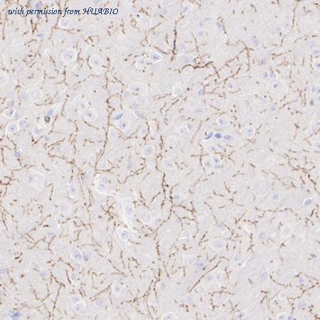 HUABIO HA750976 image 3