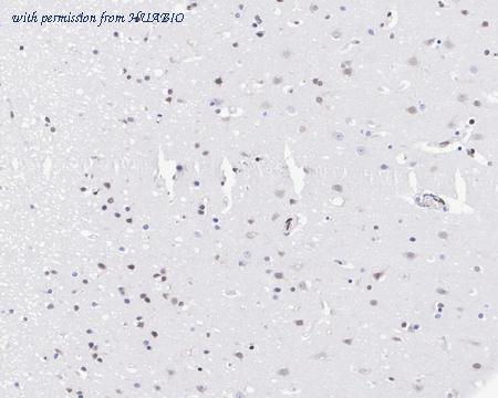 HUABIO HA750979 image 3