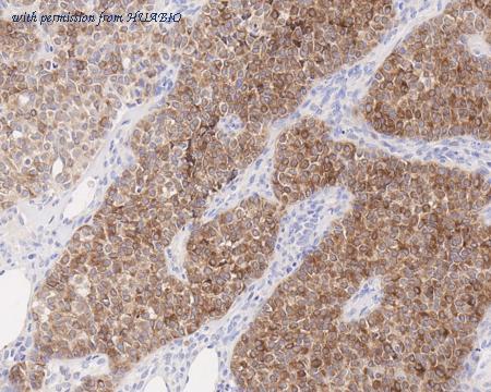 HUABIO HA751016 image 3