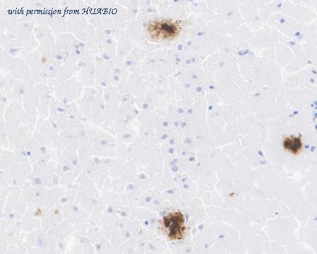 HUABIO HA751034 image 2