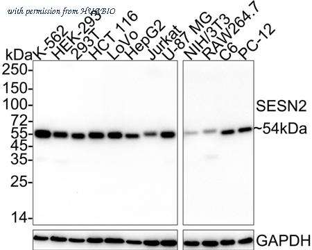 HUABIO HA751038 image 1