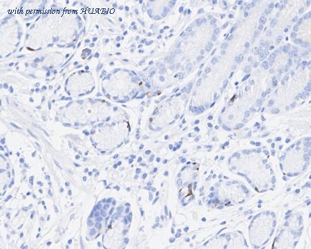 HUABIO HA751045 image 2