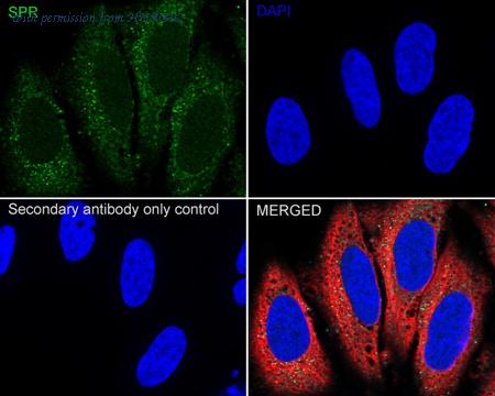 HUABIO HA751052 image 2