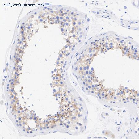 HUABIO HA751054 image 2