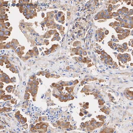 HUABIO HA751065 image 2