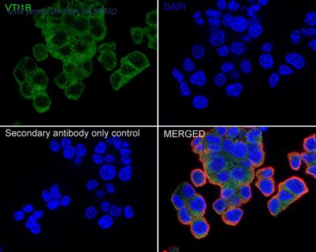 HUABIO HA751080 image 2