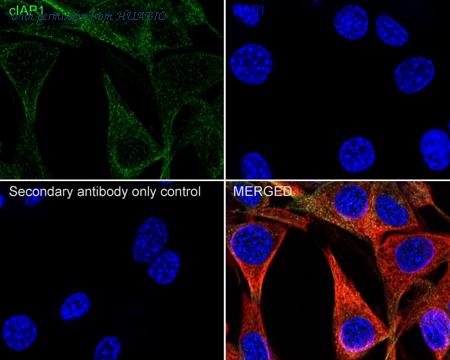 HUABIO HA751101 image 3