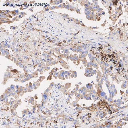 HUABIO HA751106 image 3