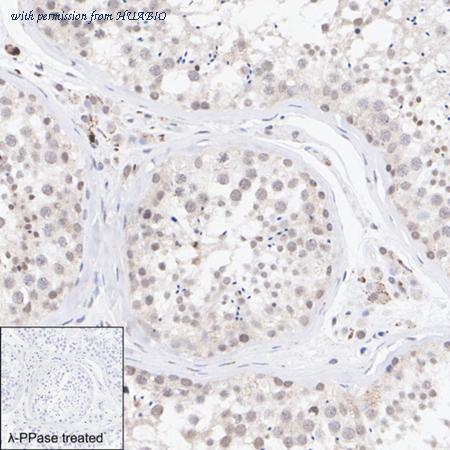 HUABIO HA751121 image 2