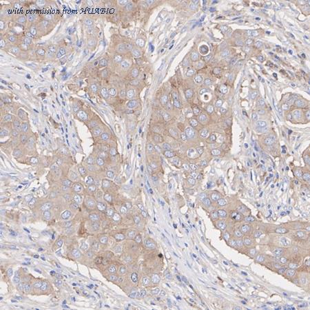 HUABIO HA751124 image 3