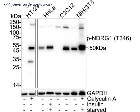 HUABIO HA751138 image 1