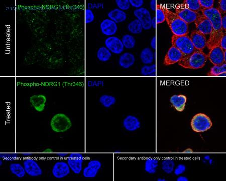 HUABIO HA751138 image 2