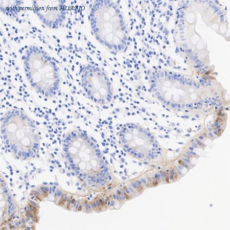 HUABIO HA751148 image 3