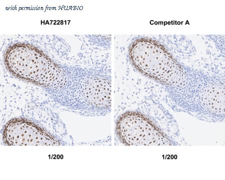 HUABIO HA751150 image 3