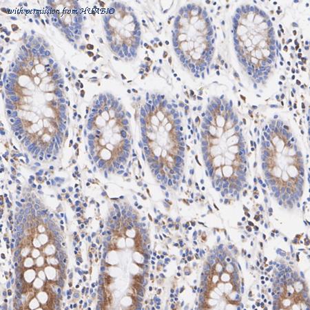 HUABIO HA751151 image 2