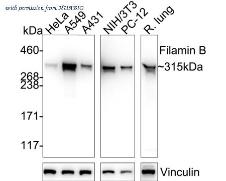 HUABIO HA751155 image 1