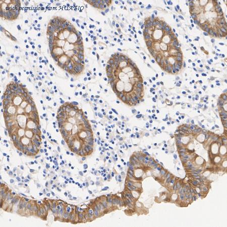 HUABIO HA751155 image 2