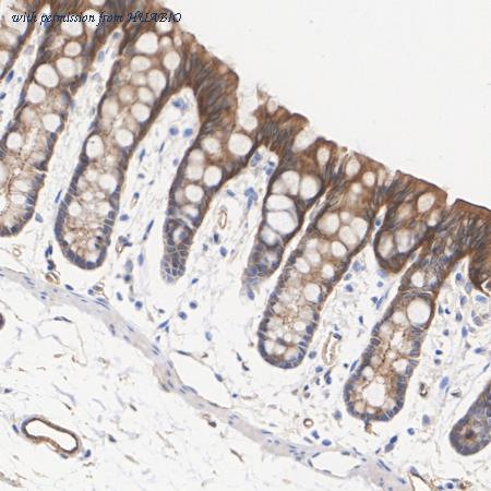 HUABIO HA751155 image 3