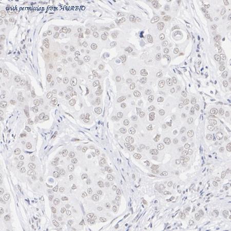 HUABIO HA751159 image 1