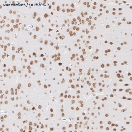 HUABIO HA751159 image 3