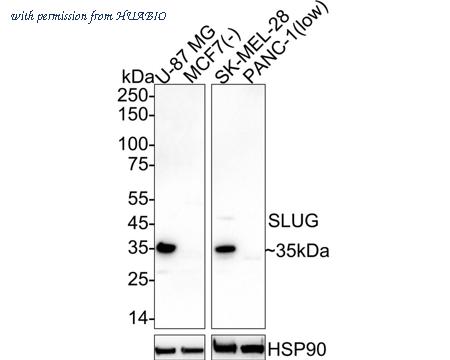 HUABIO HA751161 image 1