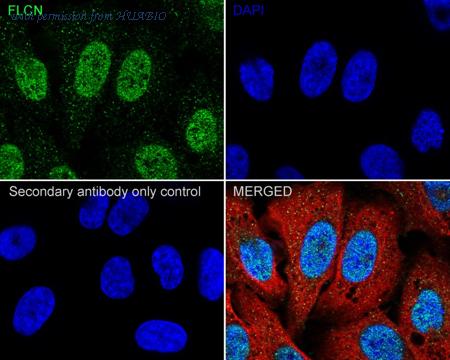 HUABIO HA751180 image 3