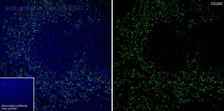 HUABIO HA751188 image 3