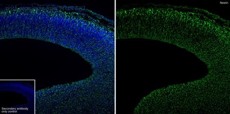 HUABIO HA751196 image 1