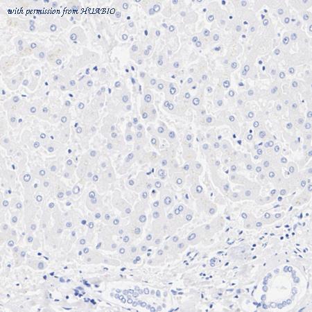 HUABIO HA751197 image 3