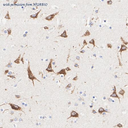 HUABIO HA751198 image 1