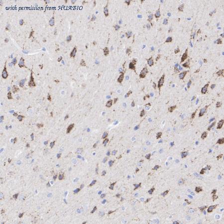 HUABIO HA751198 image 2