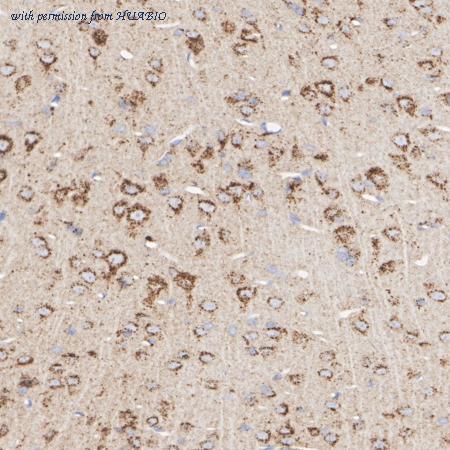 HUABIO HA751198 image 3