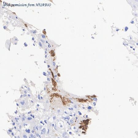 HUABIO HA751201 image 1