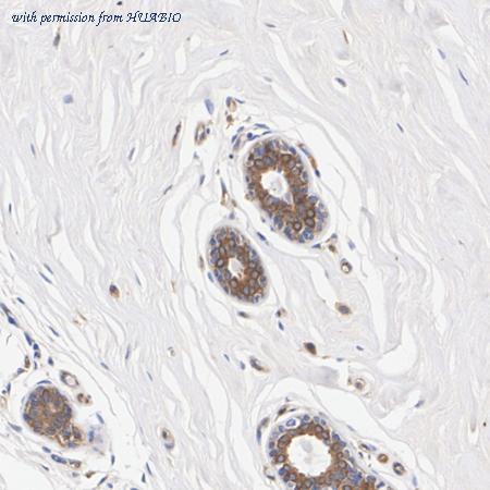 HUABIO HA751217 image 3