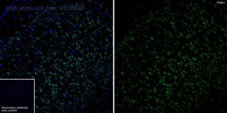 HUABIO HA751234 image 1