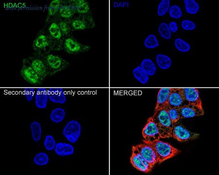 HUABIO HA751235 image 2