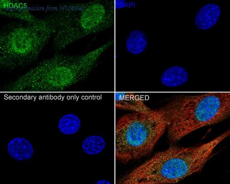 HUABIO HA751235 image 3