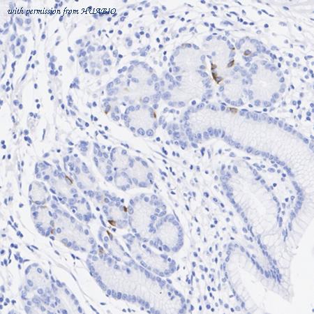 HUABIO HA751242 image 3