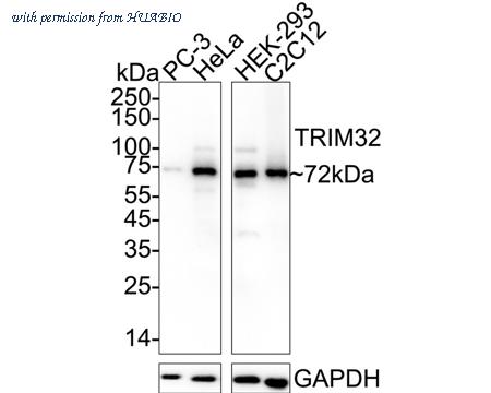 HUABIO HA751243 image 1