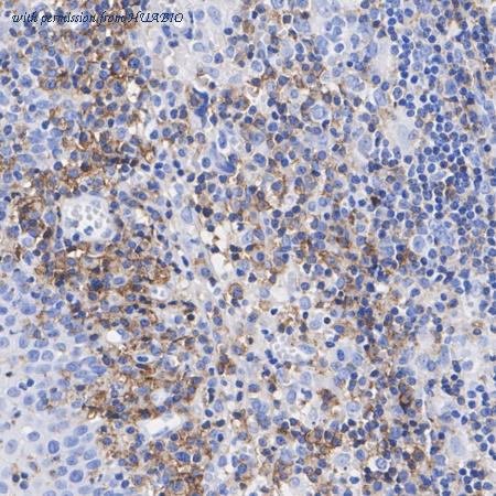 HUABIO HA751255 image 3