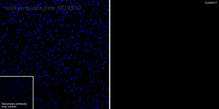 HUABIO HA751261 image 3