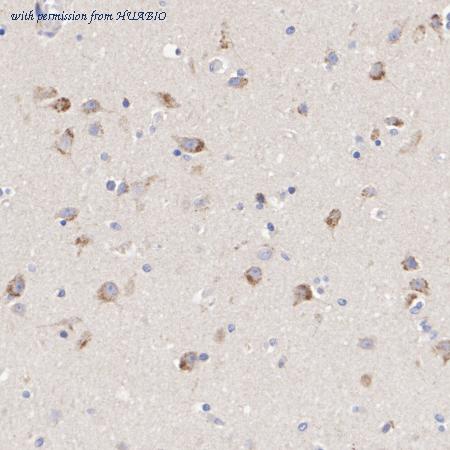 HUABIO HA751262 image 2