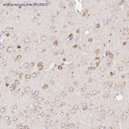 HUABIO HA751262 image 3