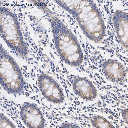 HUABIO HA751266 image 3