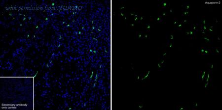 HUABIO HA751273 image 1